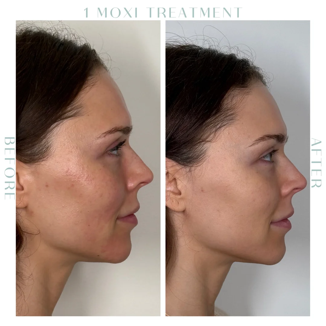 Before and after-16-in Charleston, SC