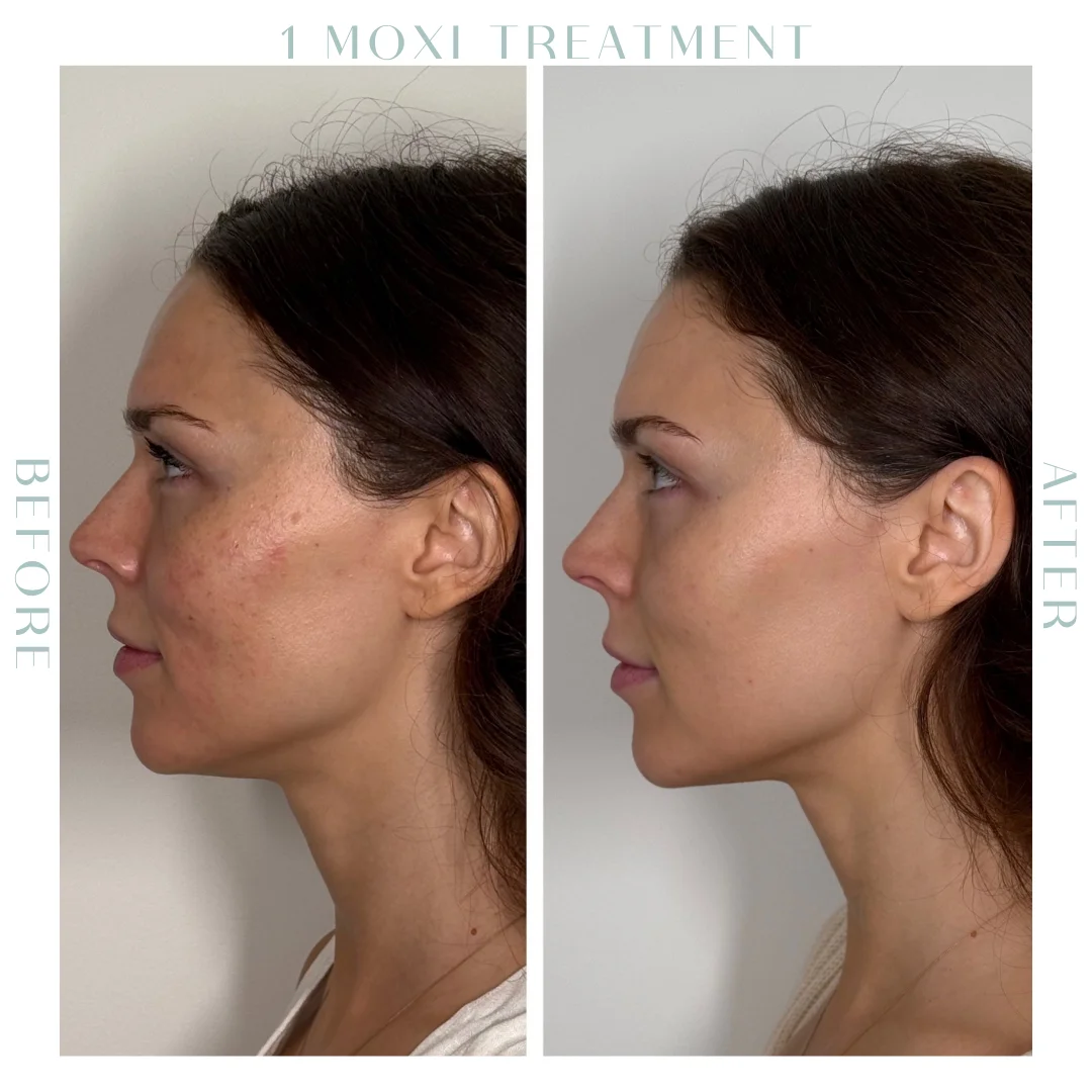 Before and after-17-in Charleston, SC