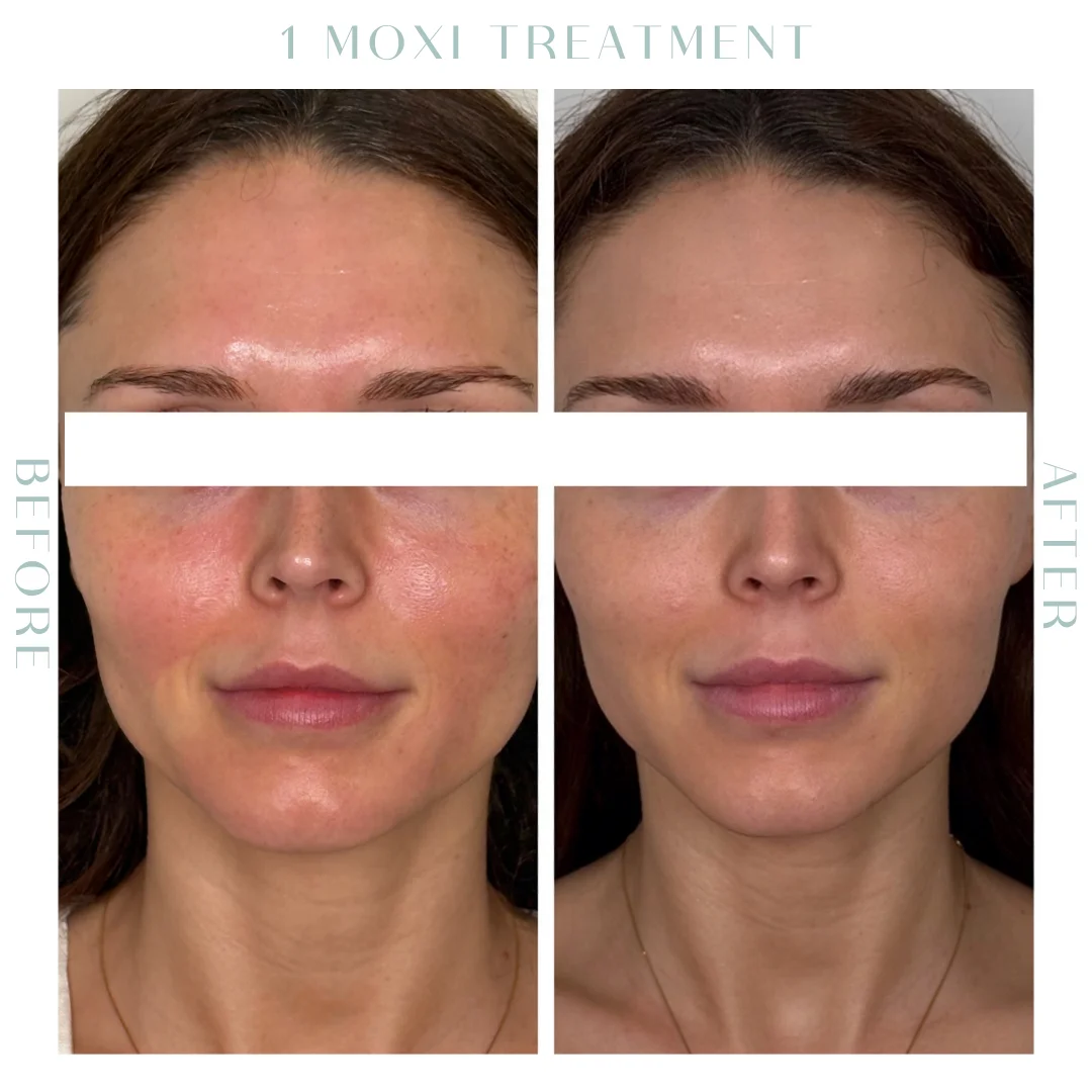 Before and after-18-in Charleston, SC