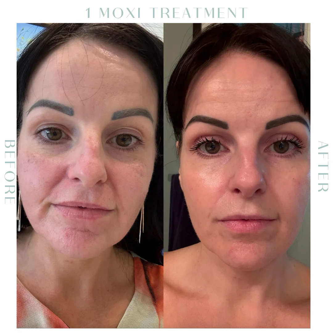 Before and after-19-in Charleston, SC