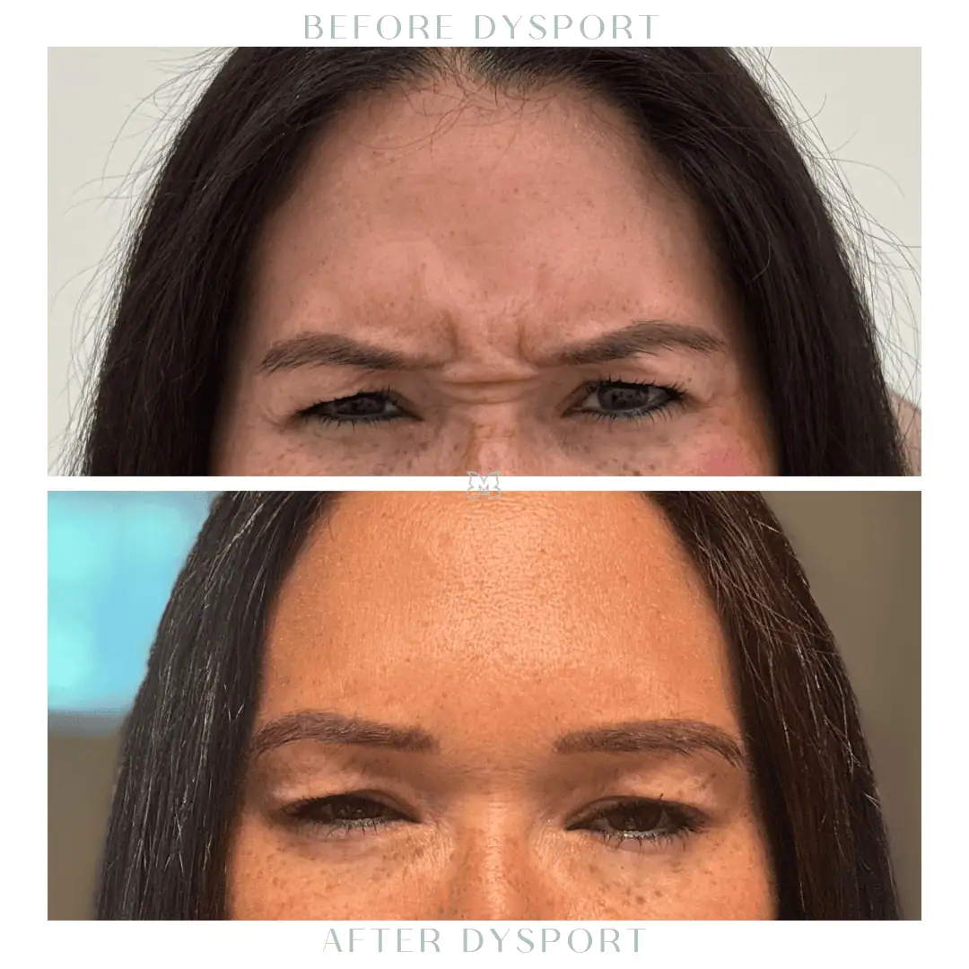 tox-before-after-1-in-Charleston-SC