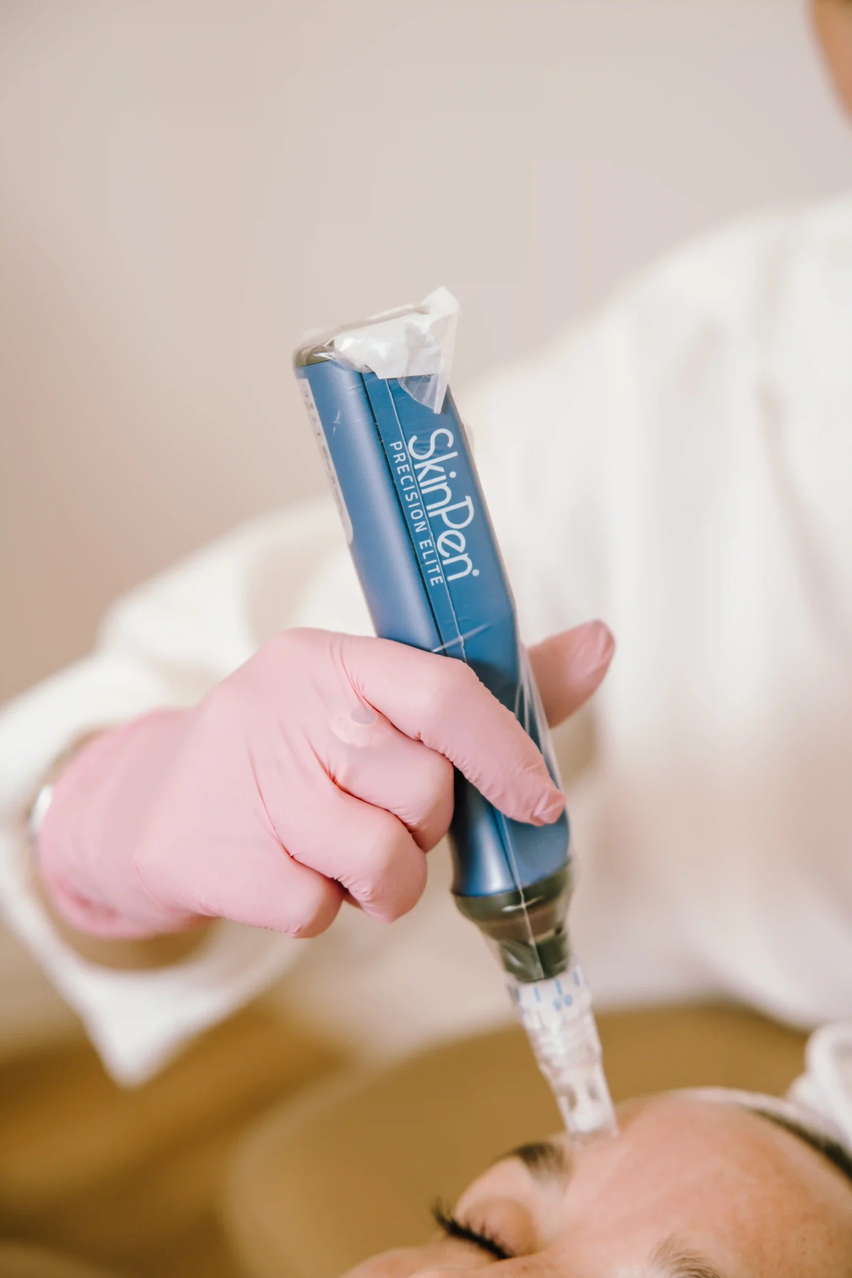 Skinpen Microneedling in Charleston, SC | PRP Collagen Therapy Skinpen Microneedling in Charleston, SC | PRP Collagen Therapy