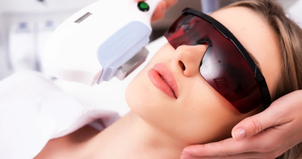 women receiving BBL Laser treatment in charleston, sc